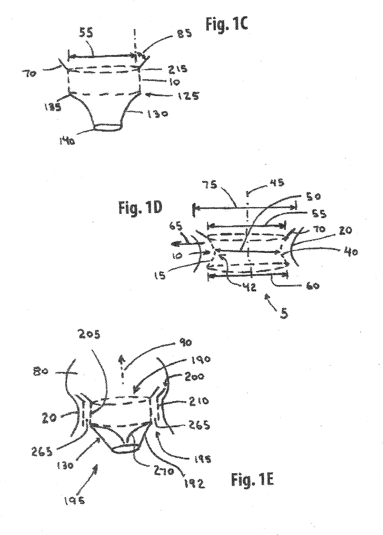 Straddle Annular Mitral Valve