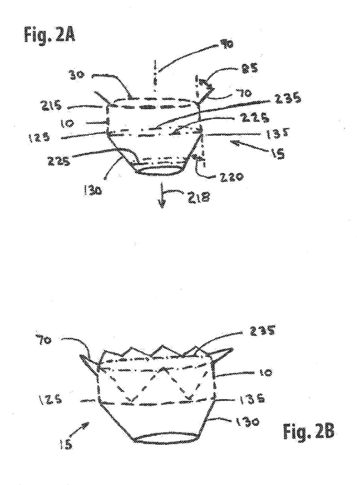 Straddle Annular Mitral Valve