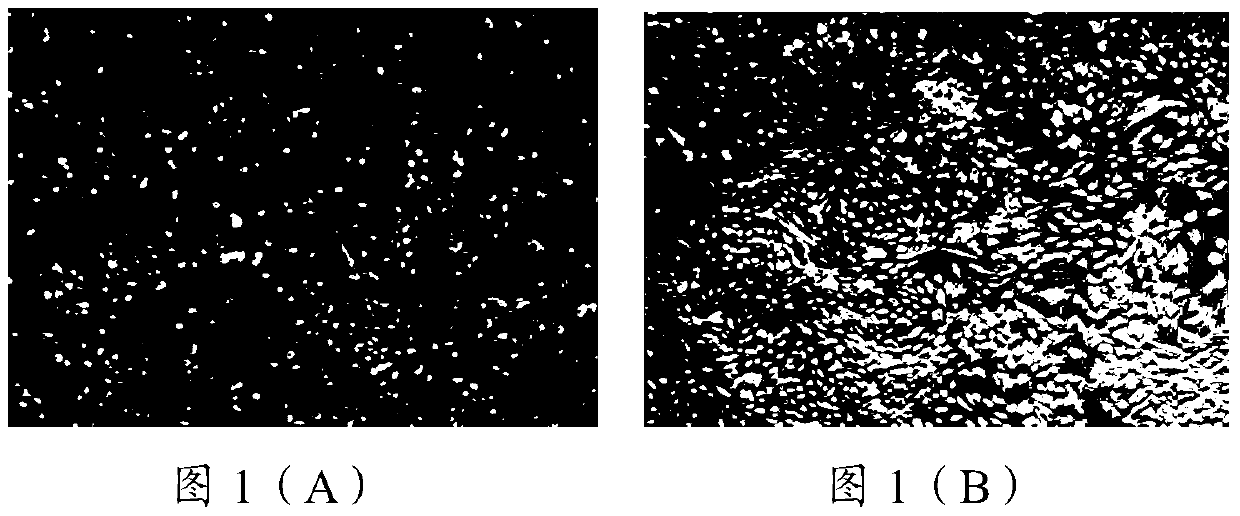 Composition and use thereof, umbilical cord preservation preparation and preparation method thereof