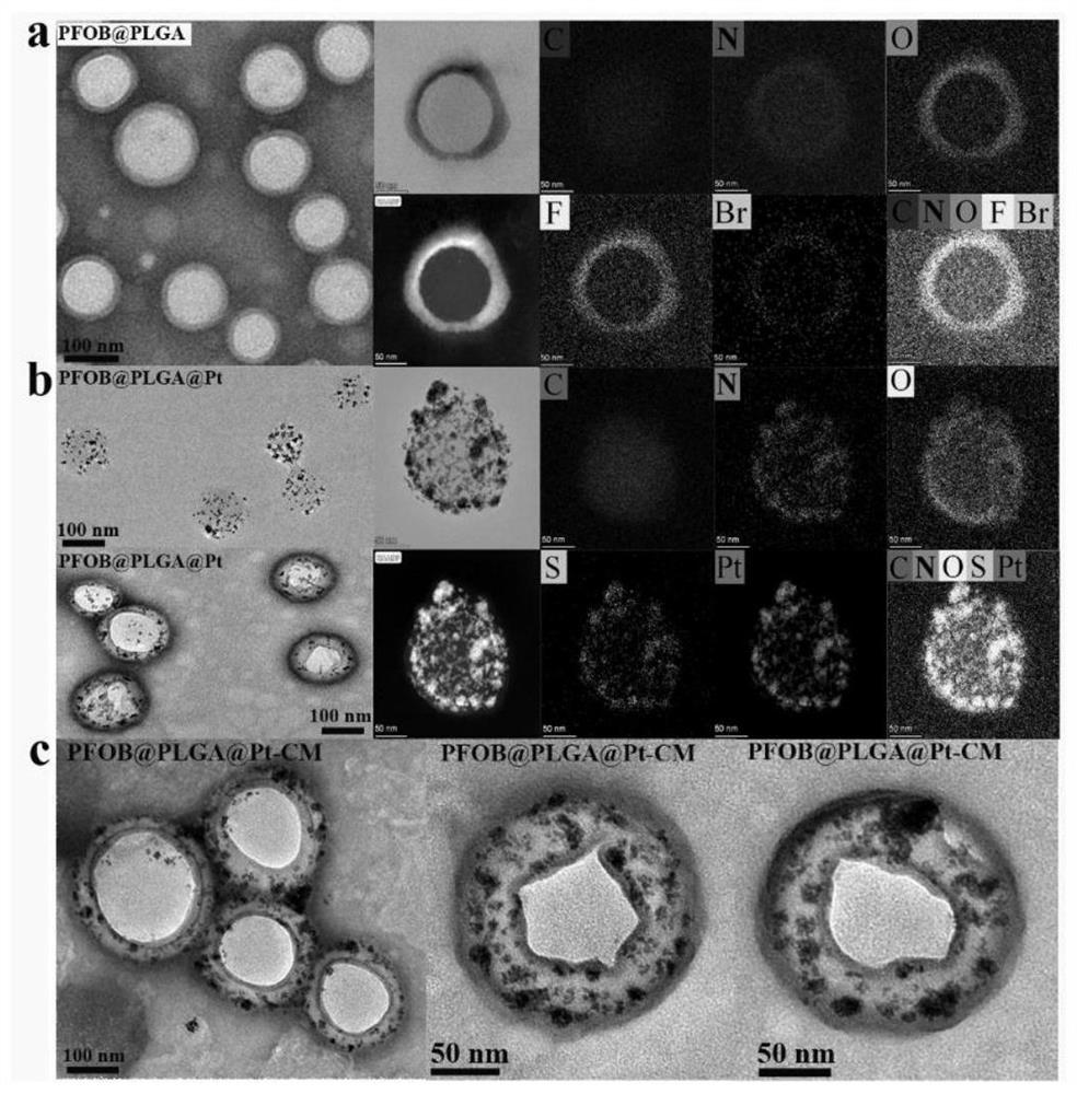 Bionic drug-loading nano-system combining cell membrane antagonism with nano-enzyme, preparation method and application