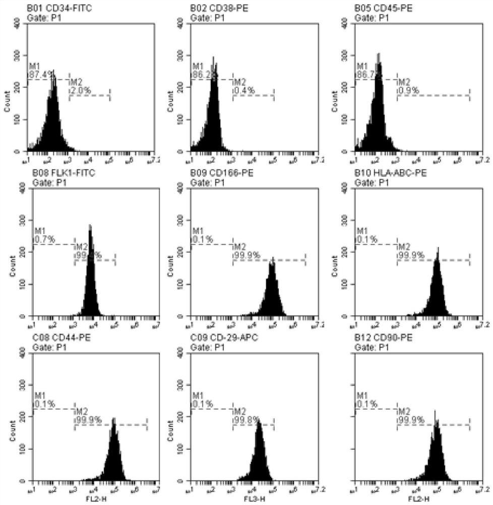 A preparation method and application method of human mesenchymal stem cell exosome freeze-dried powder