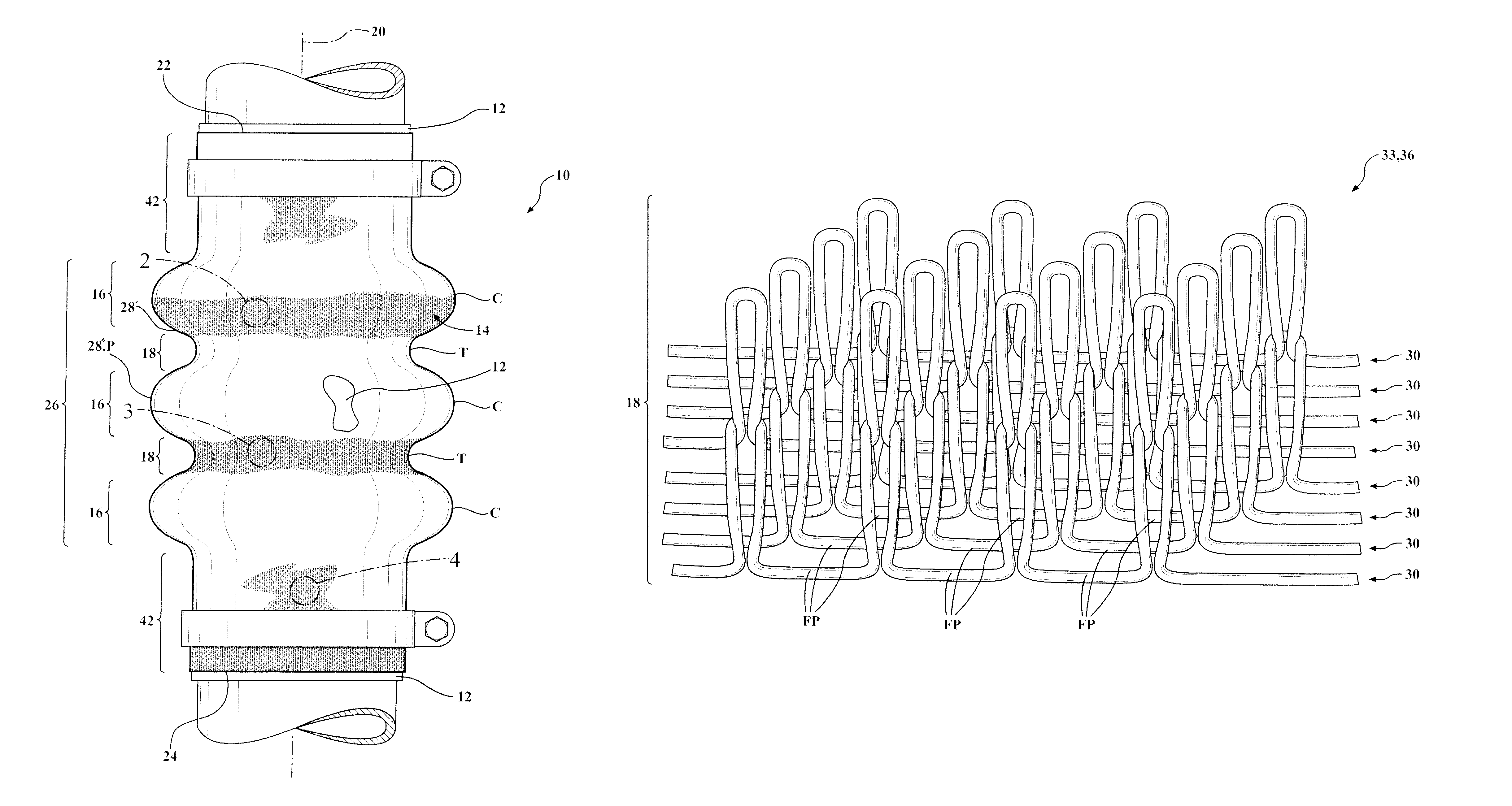 Corrugated knit sleeve and method of construction thereof