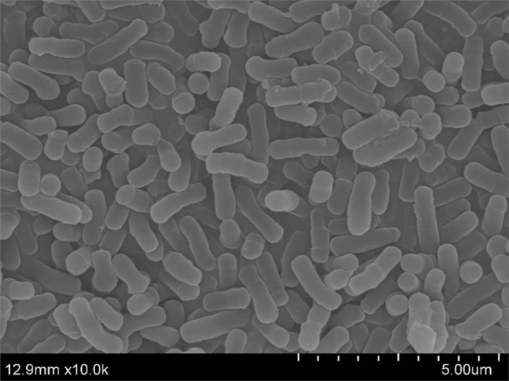 Bifidobacterium animalis subsp. Lactis strain WKB148 as well as product and application thereof