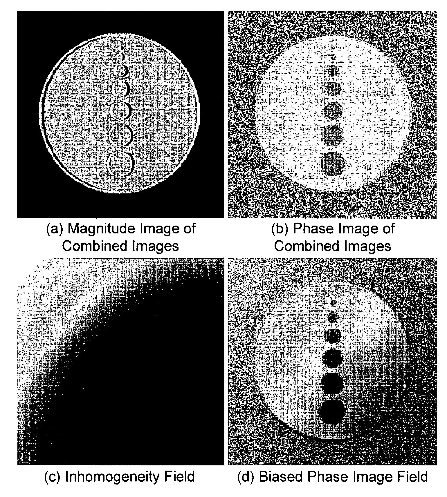 Fat/water separation and fat minimization magnetic resonance imaging systems and methods