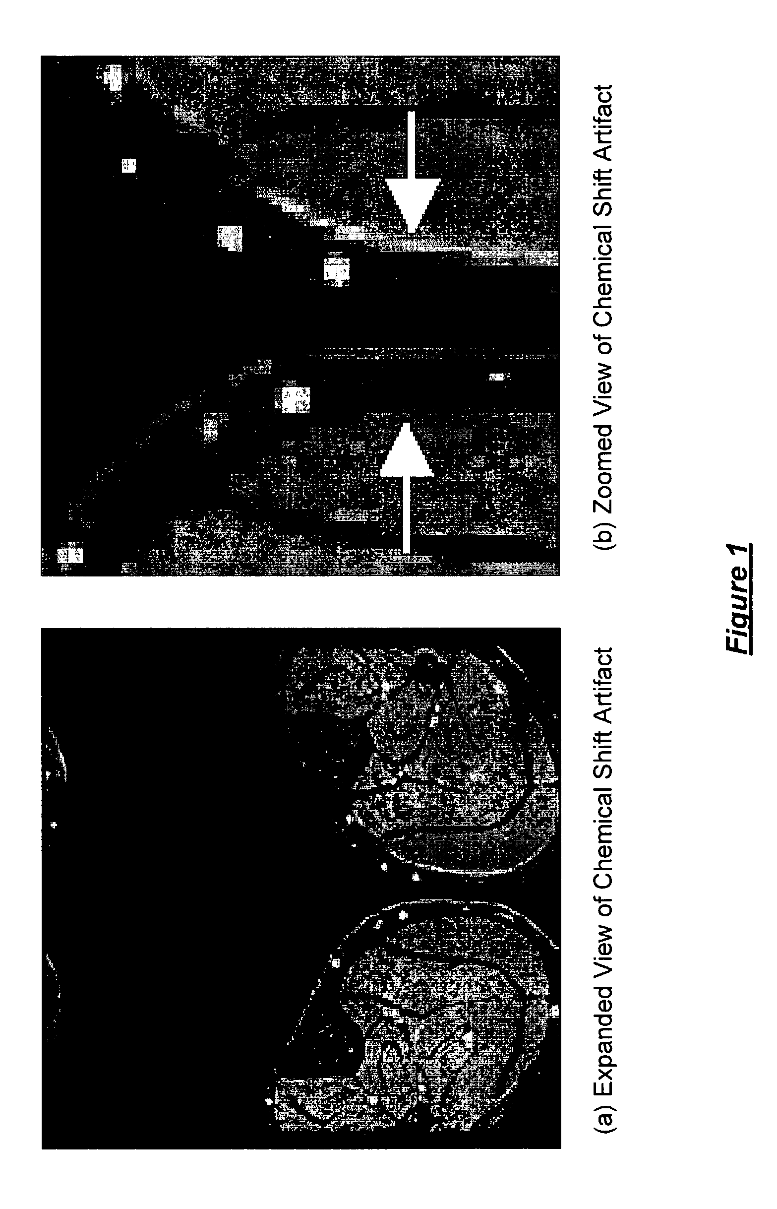 Fat/water separation and fat minimization magnetic resonance imaging systems and methods