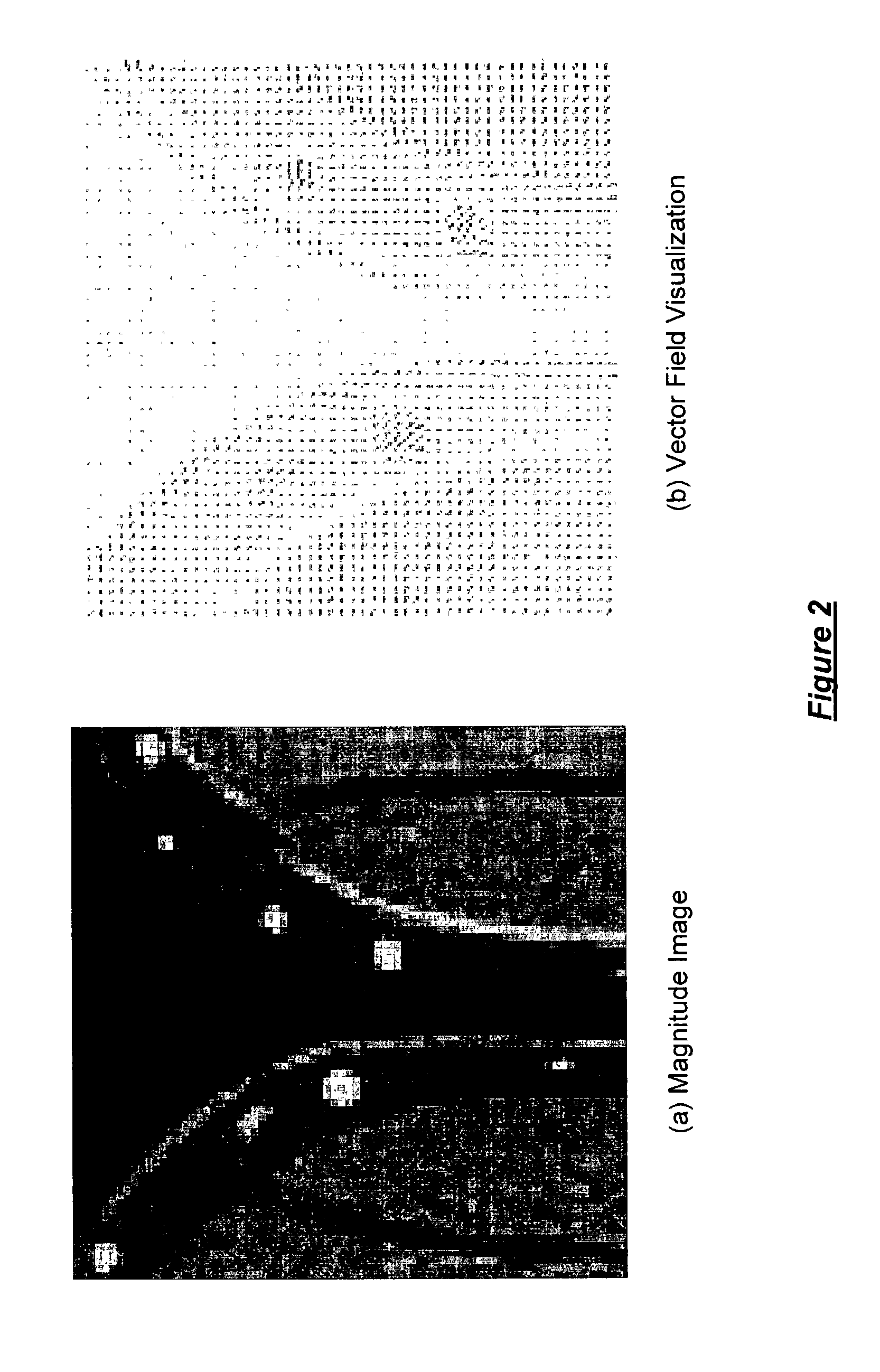 Fat/water separation and fat minimization magnetic resonance imaging systems and methods