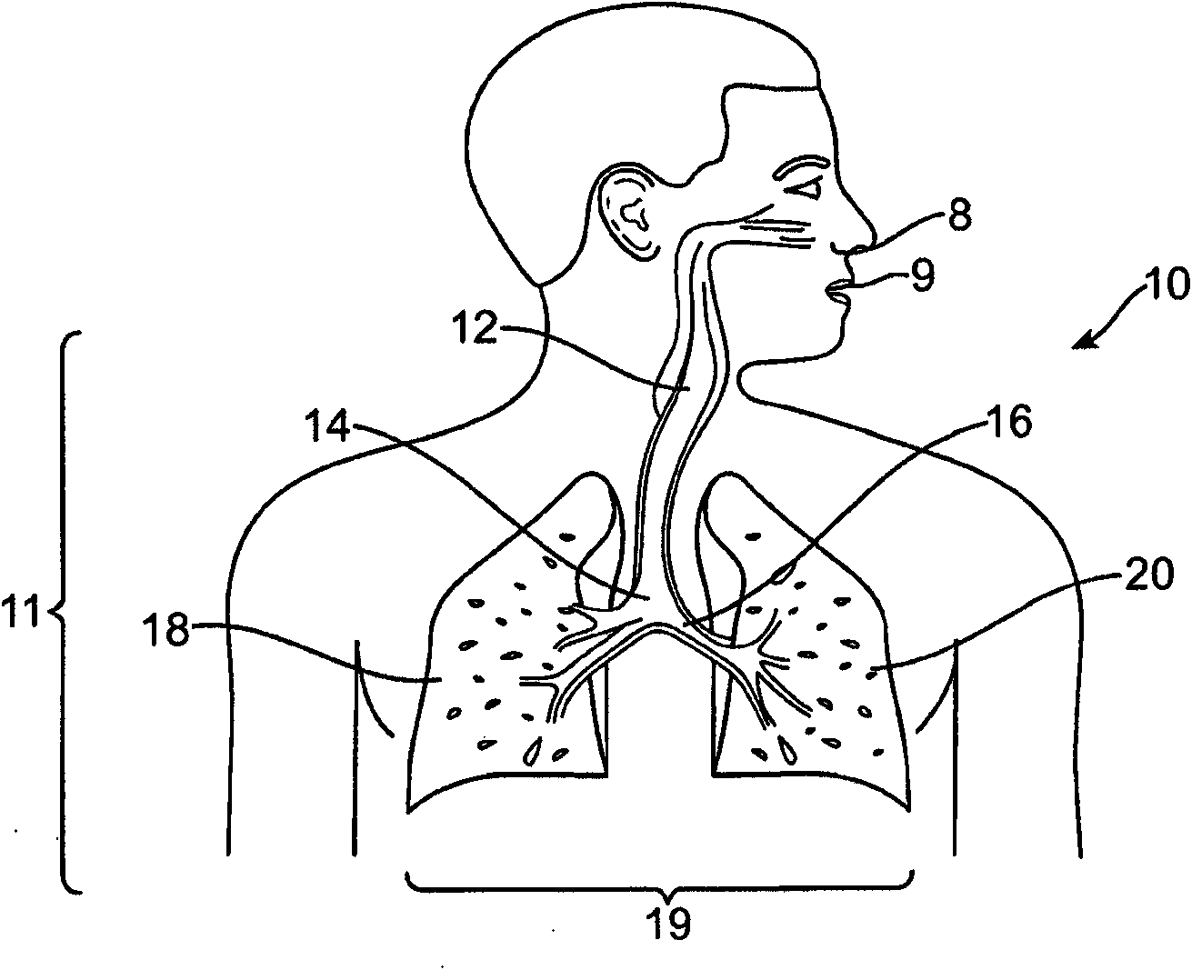 Cross-sectional modification during deployment of an elongate lung volume reduction device