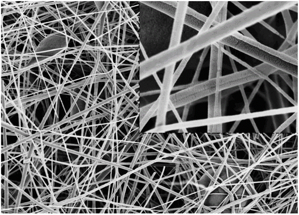 Anal fistula thread of three-dimensional composite structure and preparation method of anal fistula thread