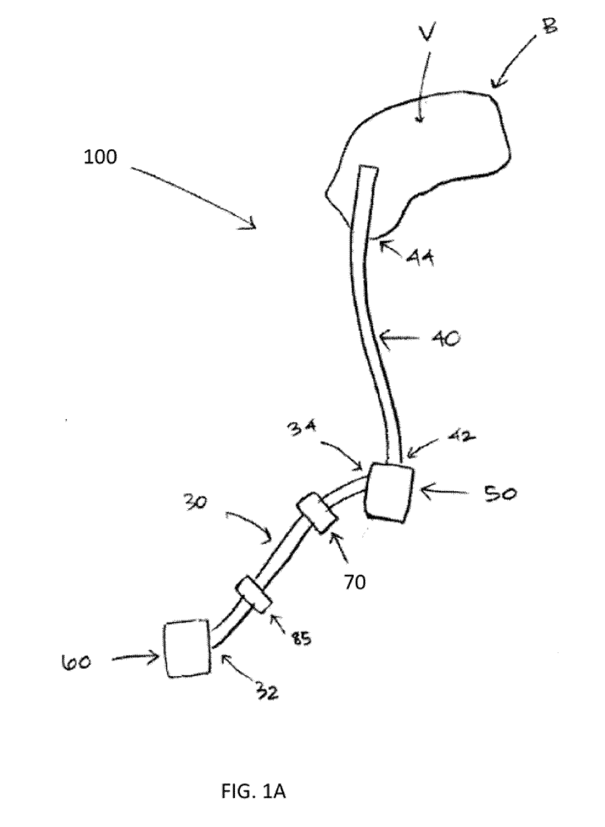 Therapeutic applications of artificial cerebrospinal fluid and tools provided therefor