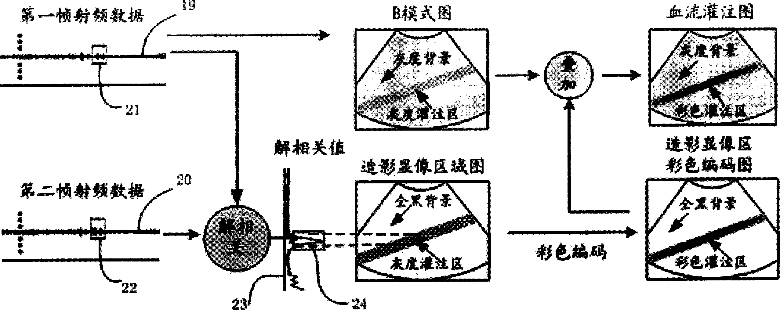 System and method of perfusion imaging and ultrasonic control releasing based-on capsule microbubble