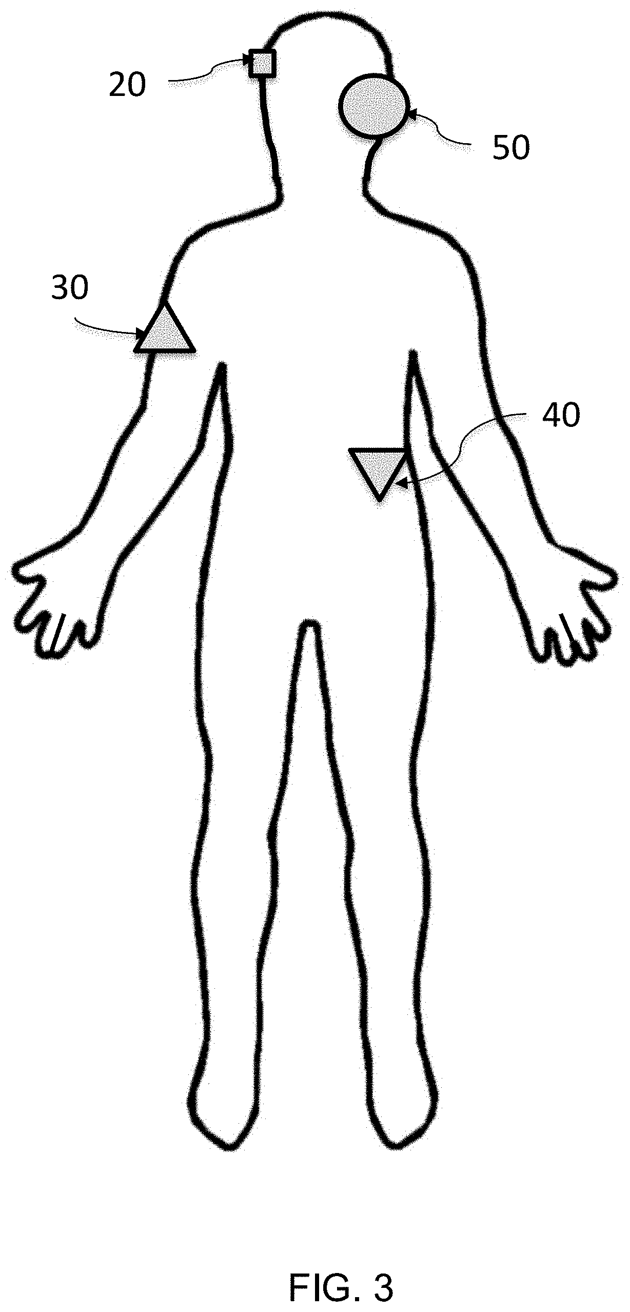 Electrical stimulation device for improving fluidity of motion