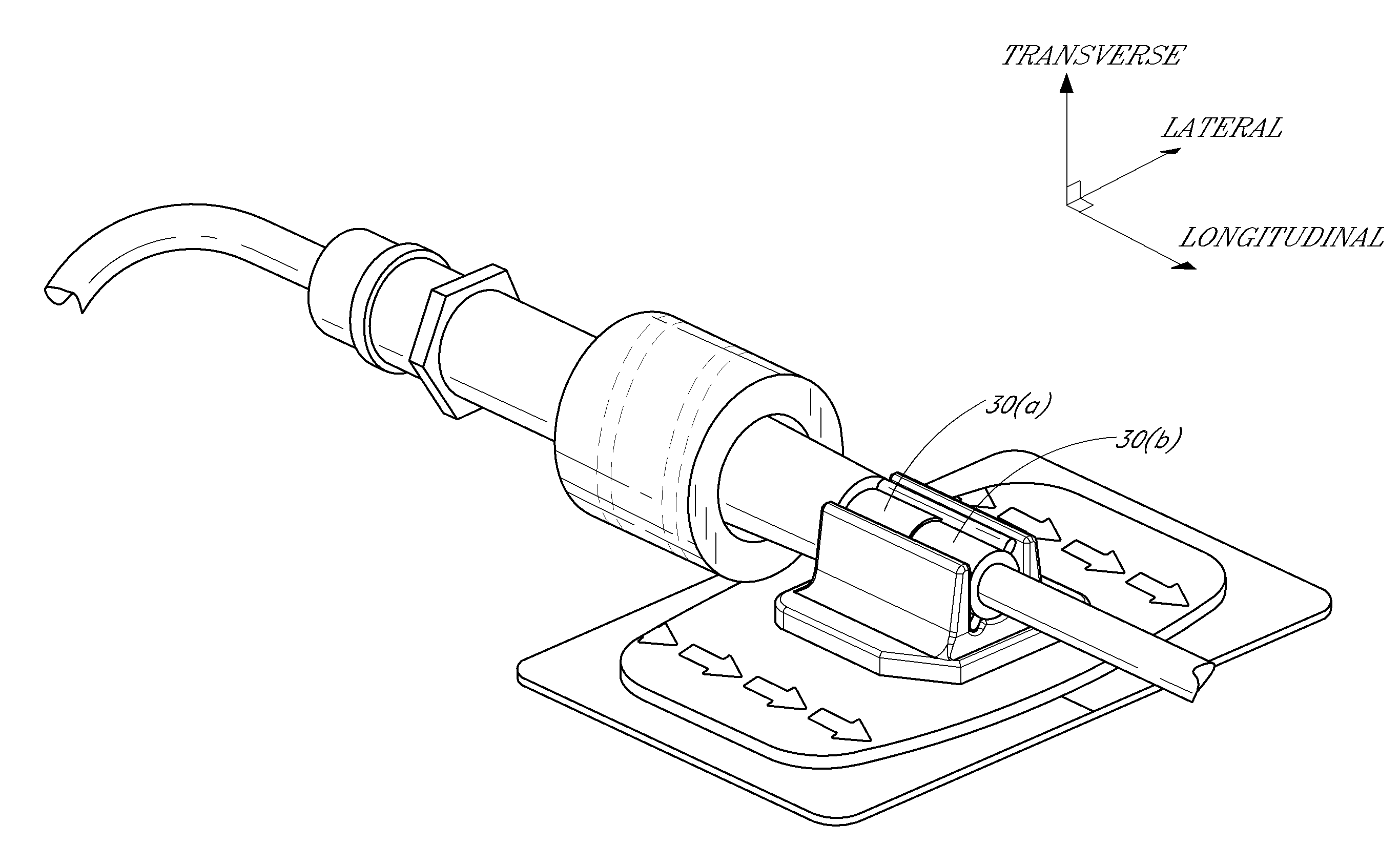 Catheter securement device