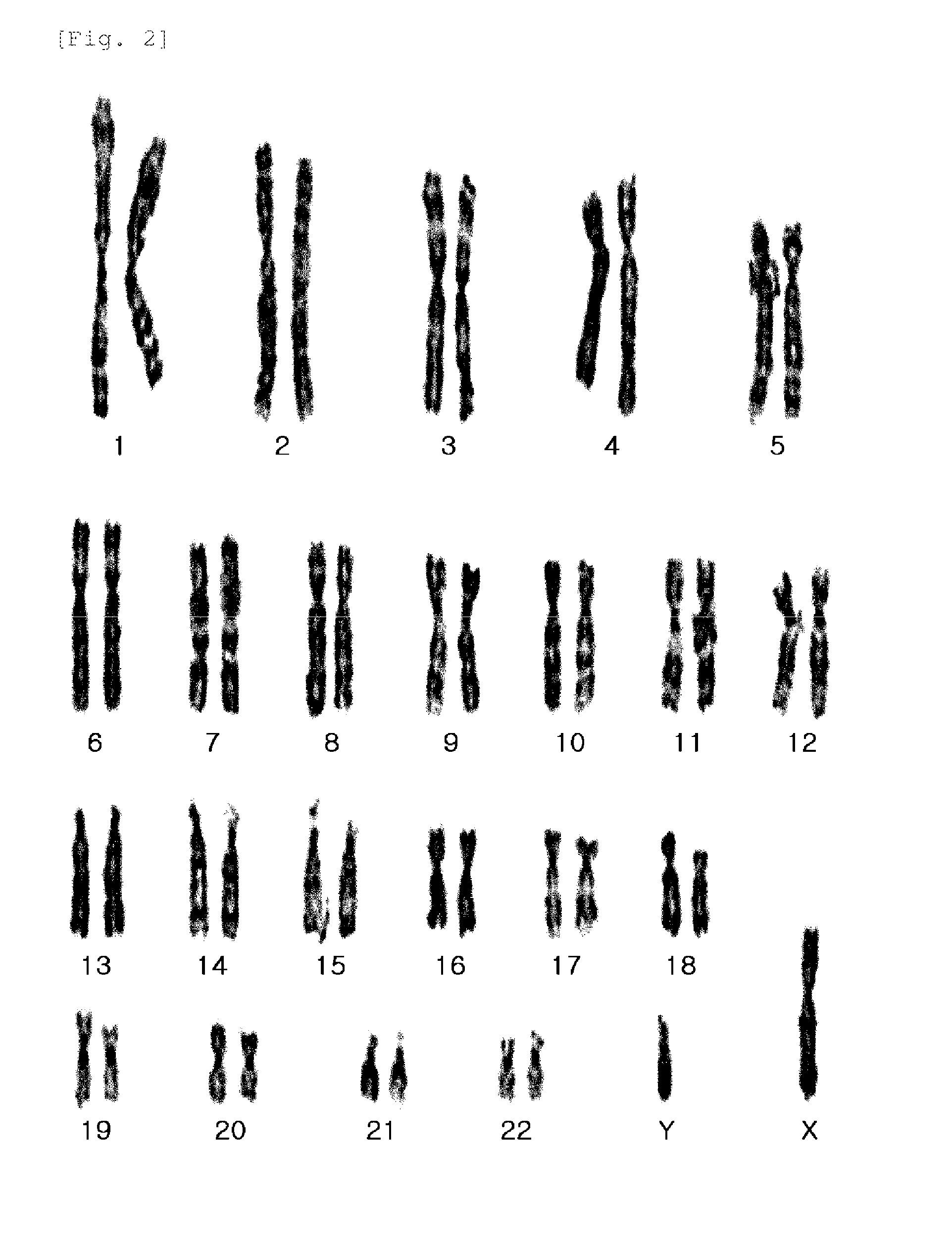 Composition for Improving Skin Conditions Using Fetal Mesenchymal Stem Cells from Amniotic Fluid