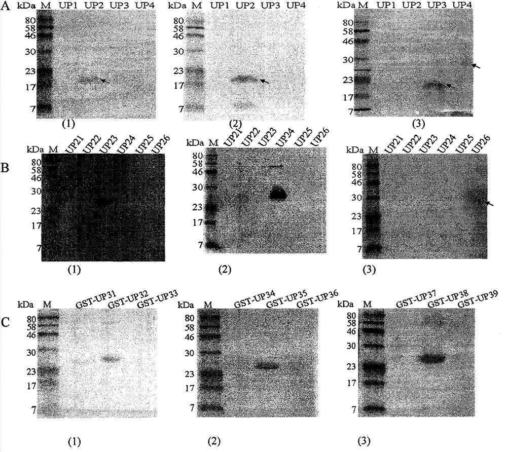 Helicobacter pylori urease B antigen epitope polypeptide and application thereof