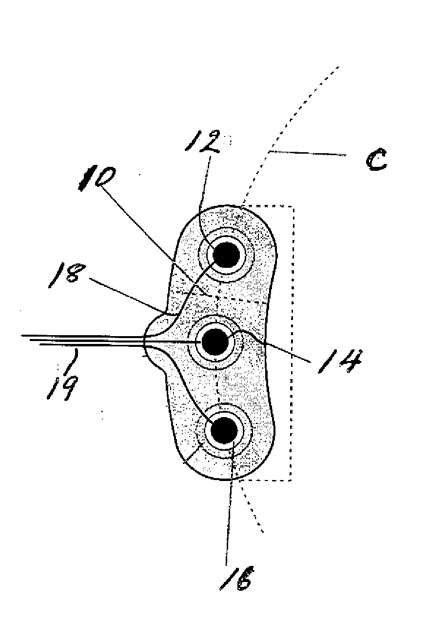 Electrode assemblies and bruxism monitoring apparatus