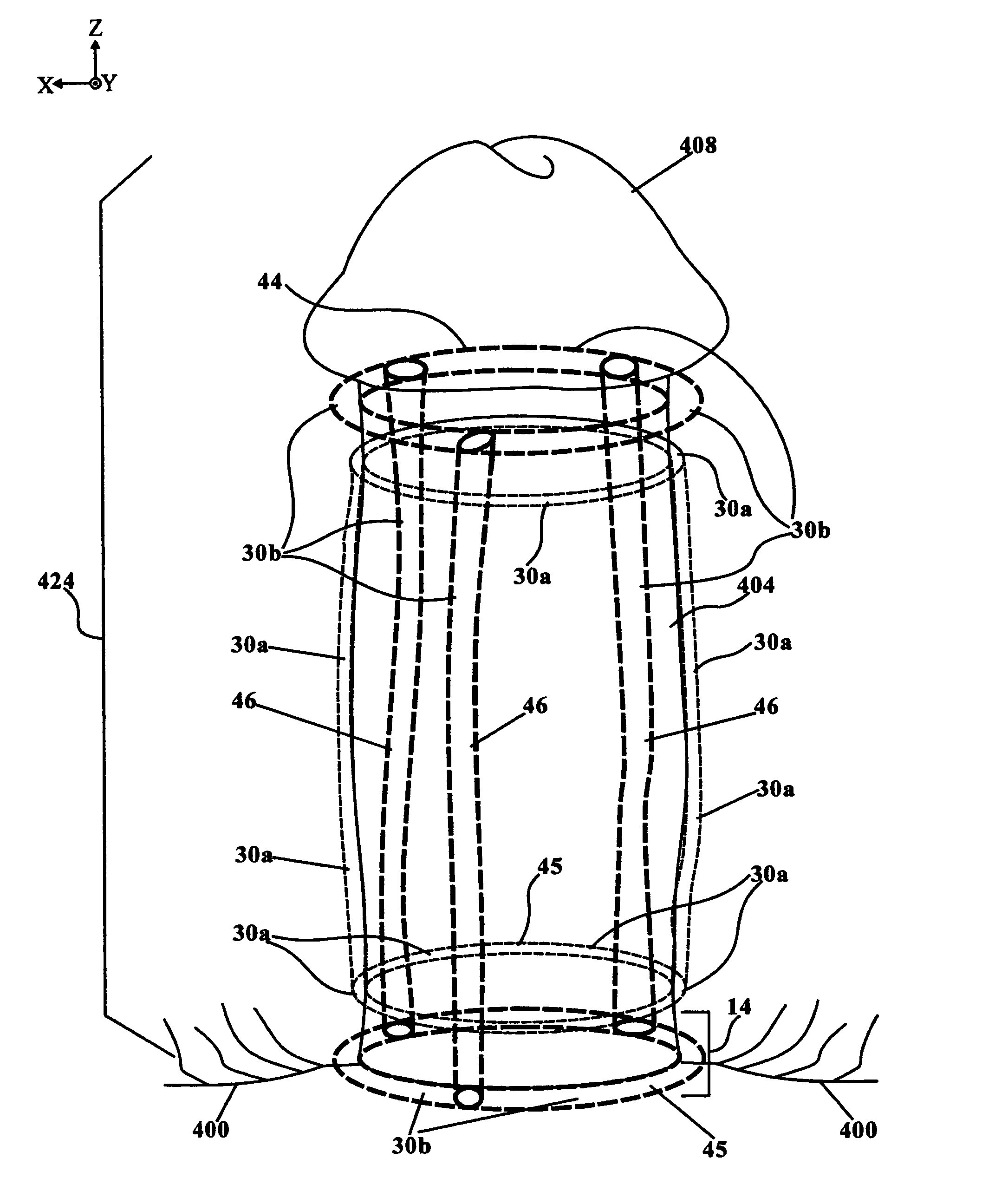 On-genital erection device and system for coital use