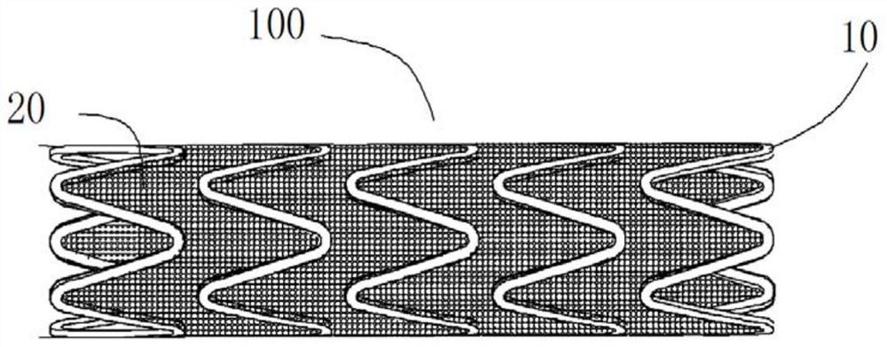 Stent