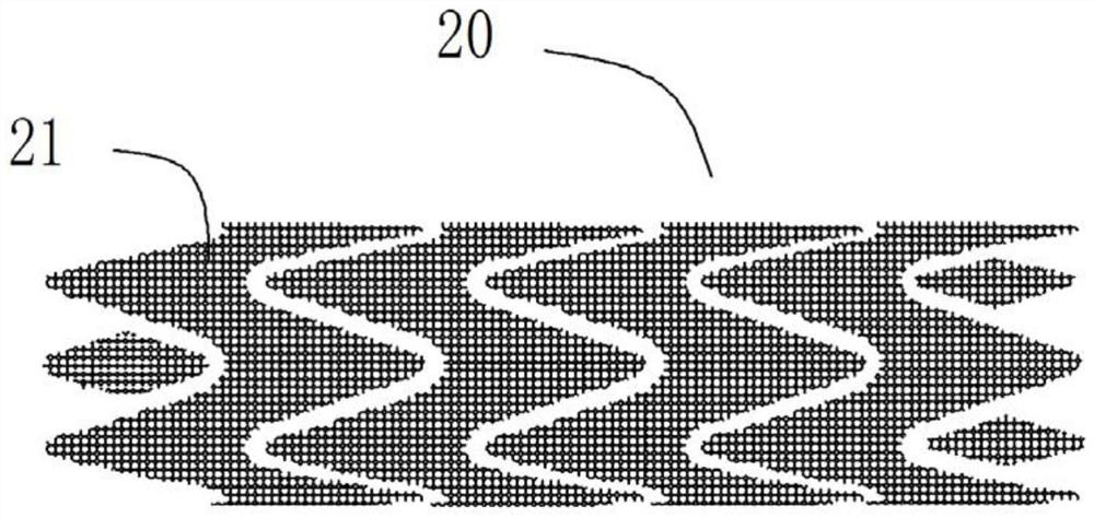 Stent