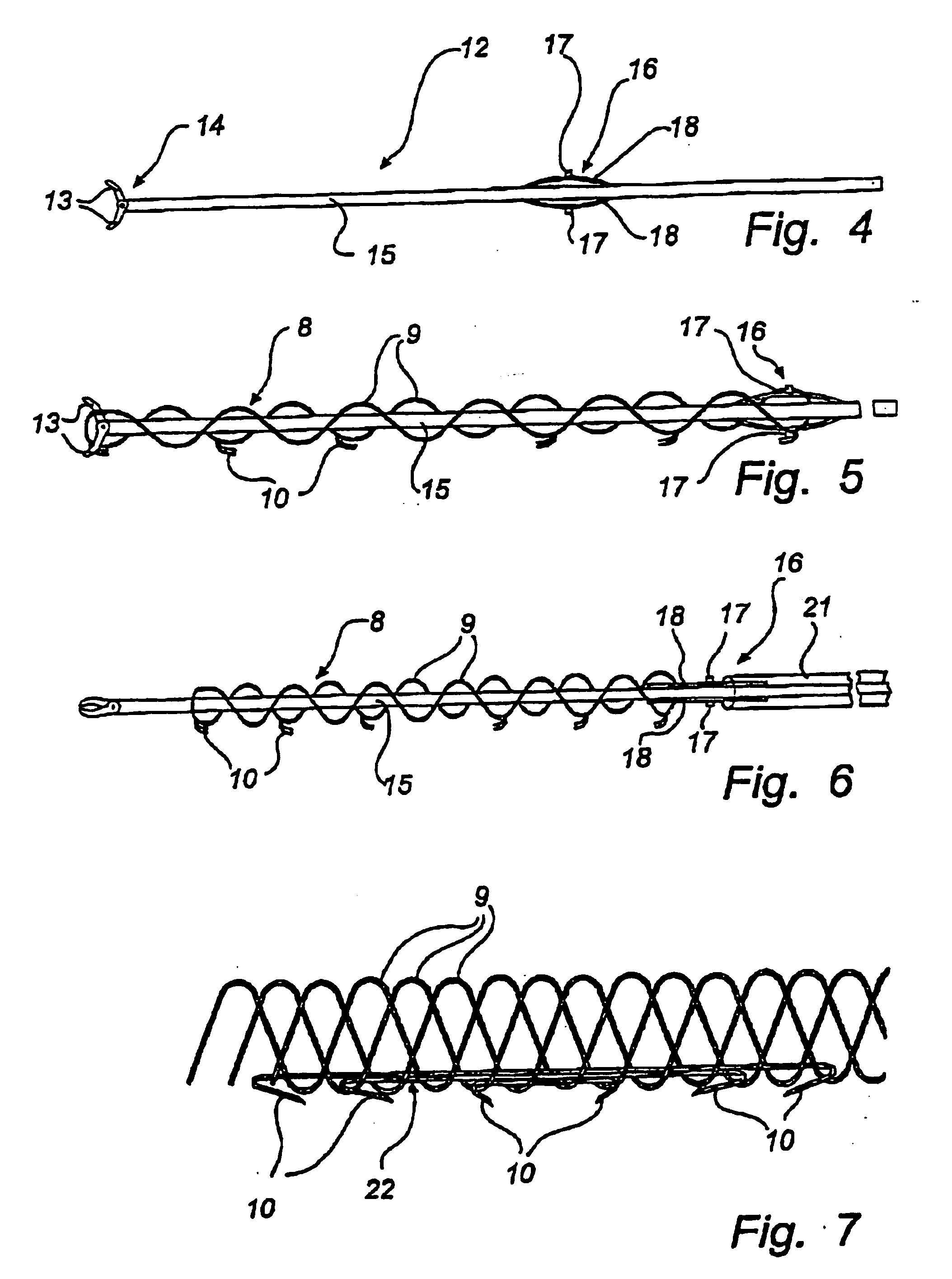 Method and device for treatment of mitral insufficiency