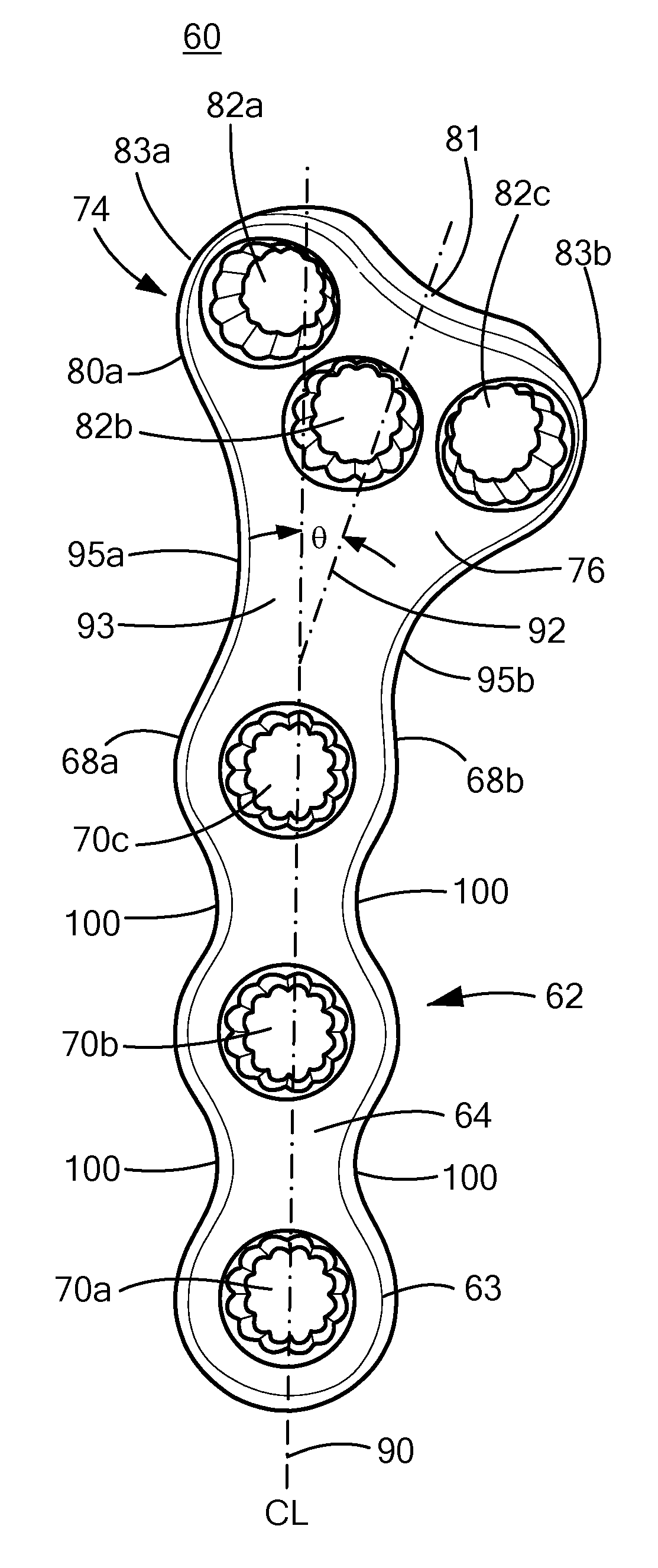 Tplo bone plate