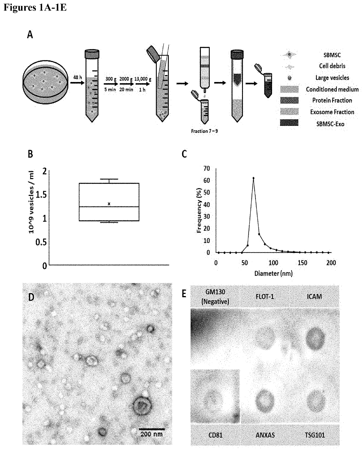 Methods of preventative therapy for post-traumatic osteoarthritis