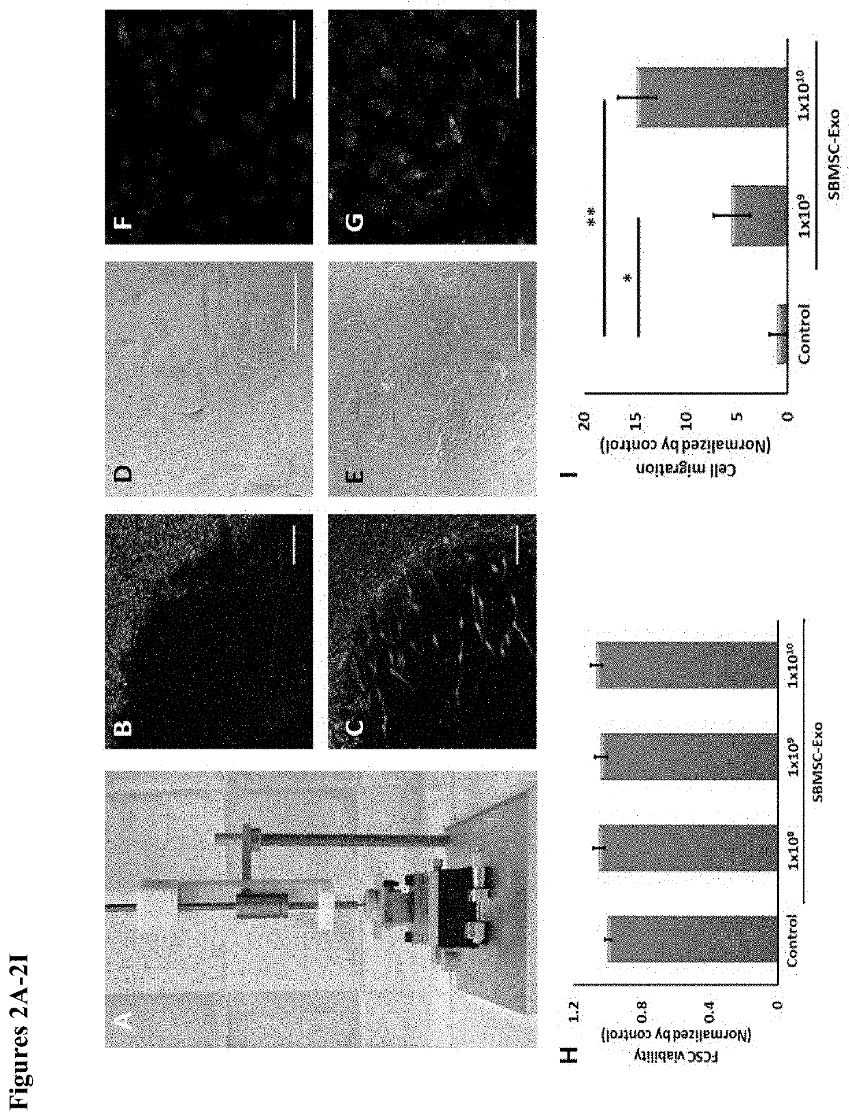 Methods of preventative therapy for post-traumatic osteoarthritis