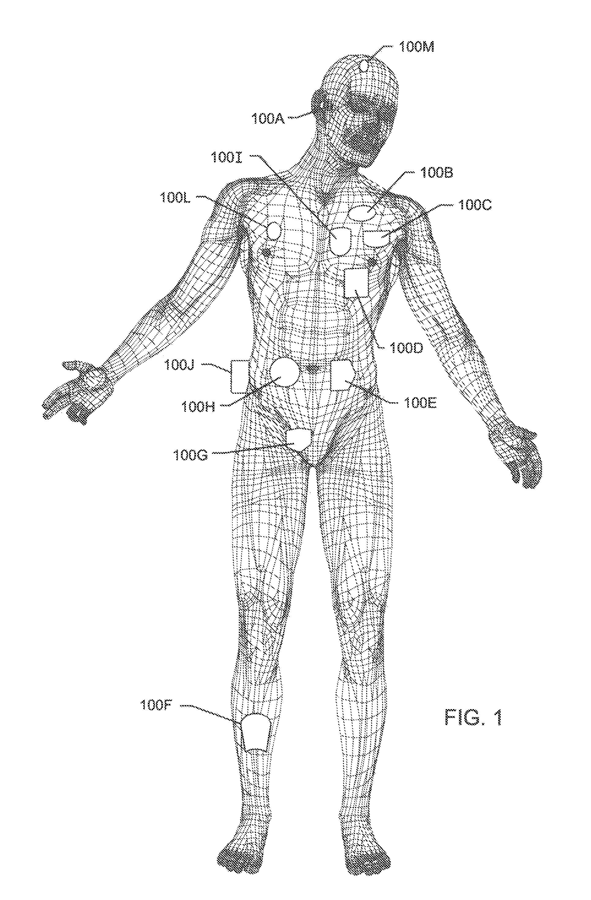 Low impedance oxide resistant grounded capacitor for an AIMD