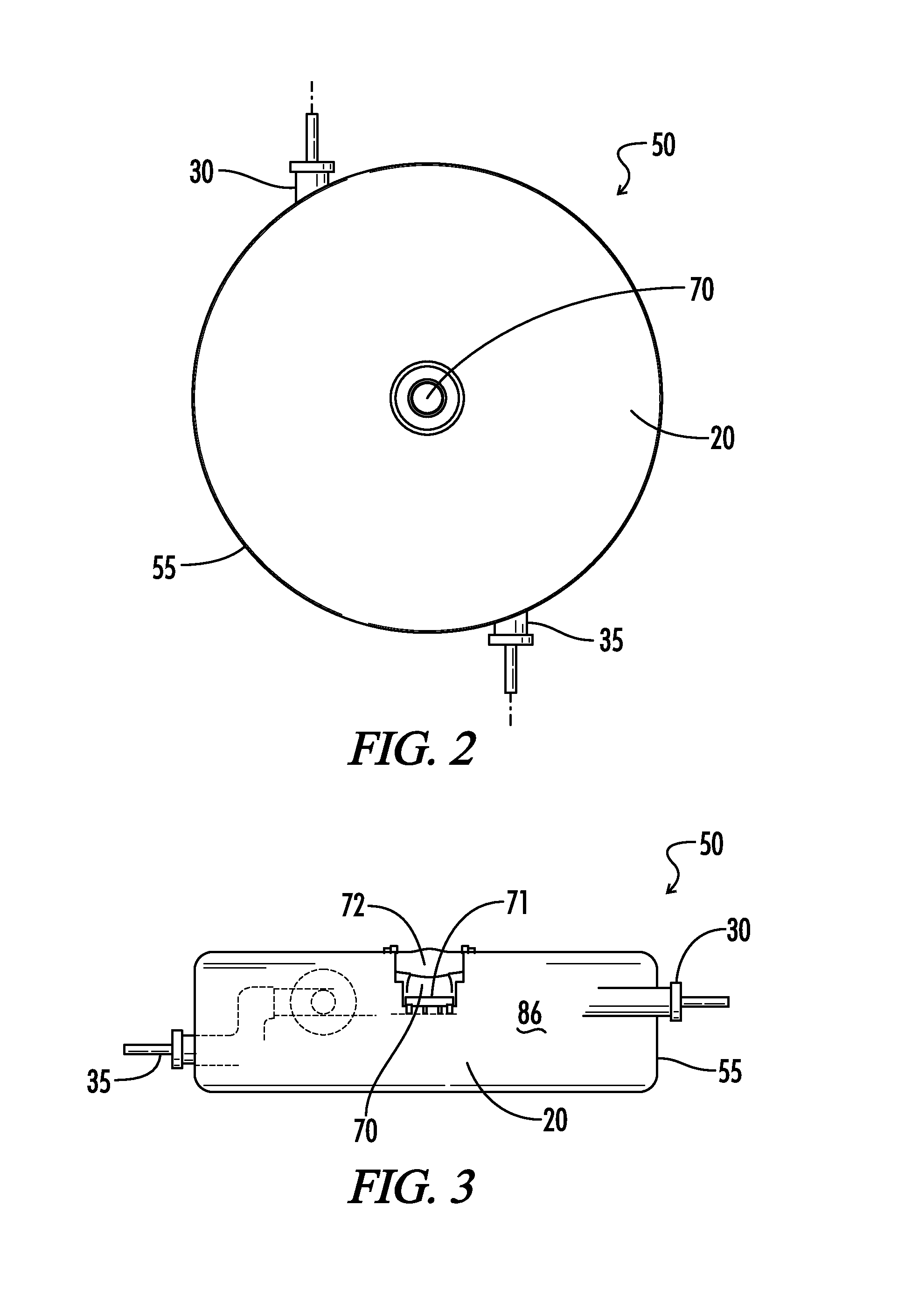 Implantable pump for removal of cerebrospinal fluid