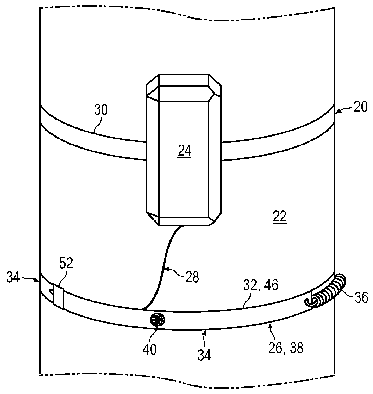 Dendrometer