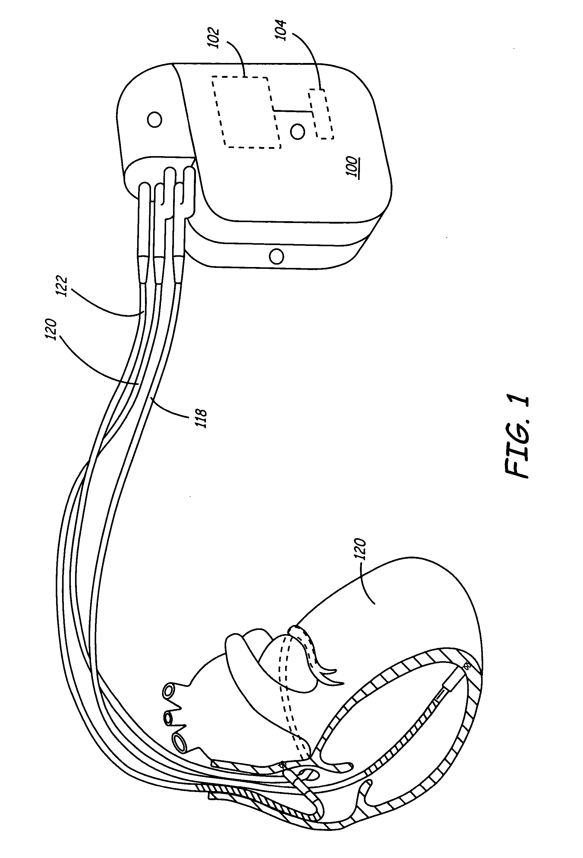 Method and apparatus for improving ventricular status using the force interval relationship