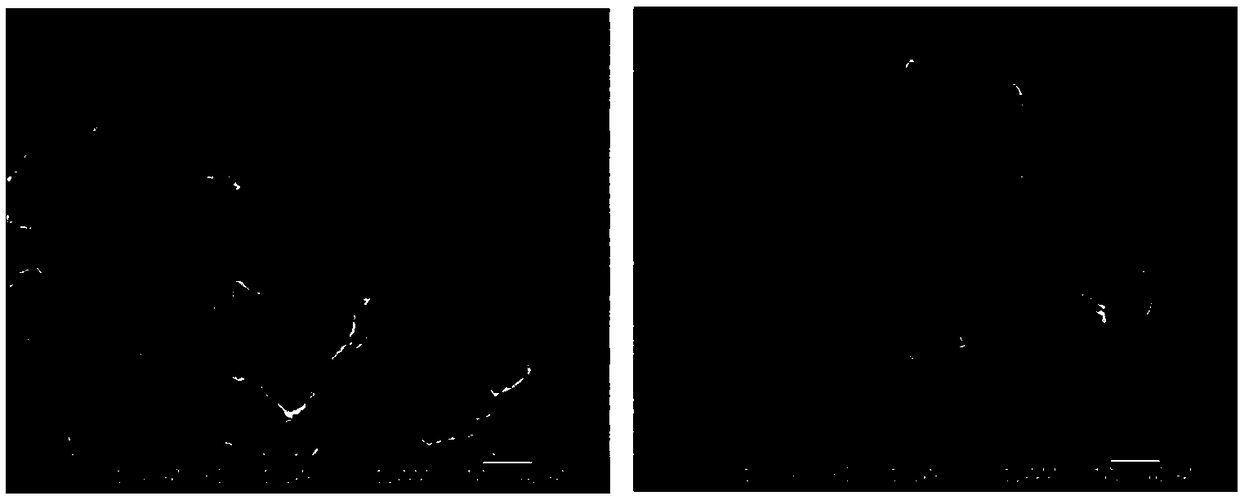 Method for preparing synergistic sunscreen micron capsule by virtue of composite condensation