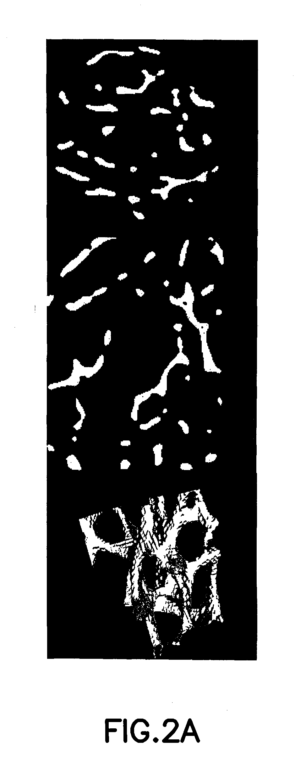 Diffusion-based magnetic resonance methods for characterizing bone structure