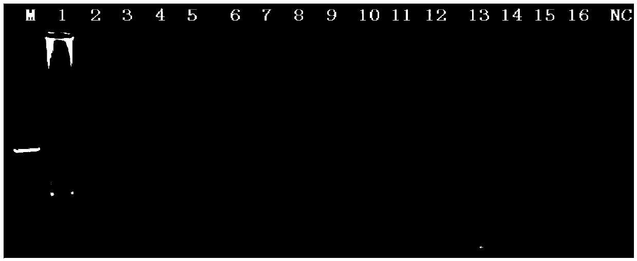 LAMP (loop-mediated isothermal amplification) detection kit of vibrio cholerae and detection method thereof