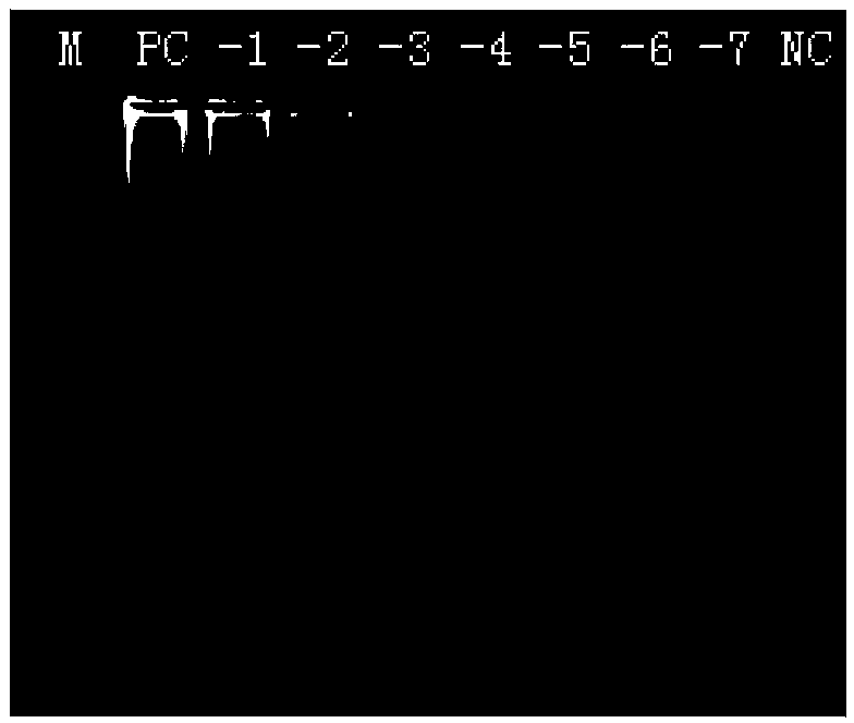 LAMP (loop-mediated isothermal amplification) detection kit of vibrio cholerae and detection method thereof