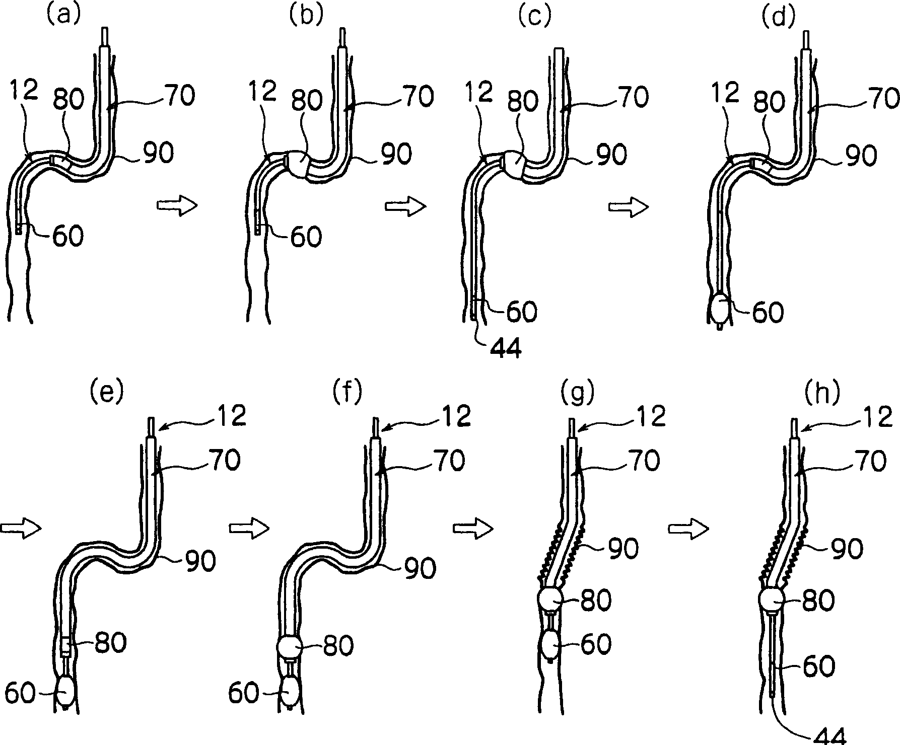 Endoscope device and control method for the same