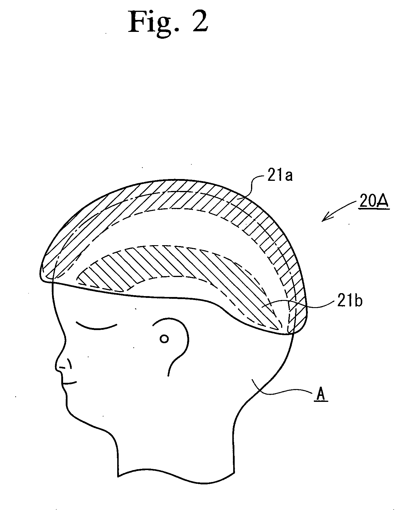 Ultrasonic Cerebral Infarction Therapeutic Apparatus