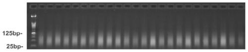 Gene mutation detection kit for human glucose-6-phosphate dehydrogenase deficiency disease