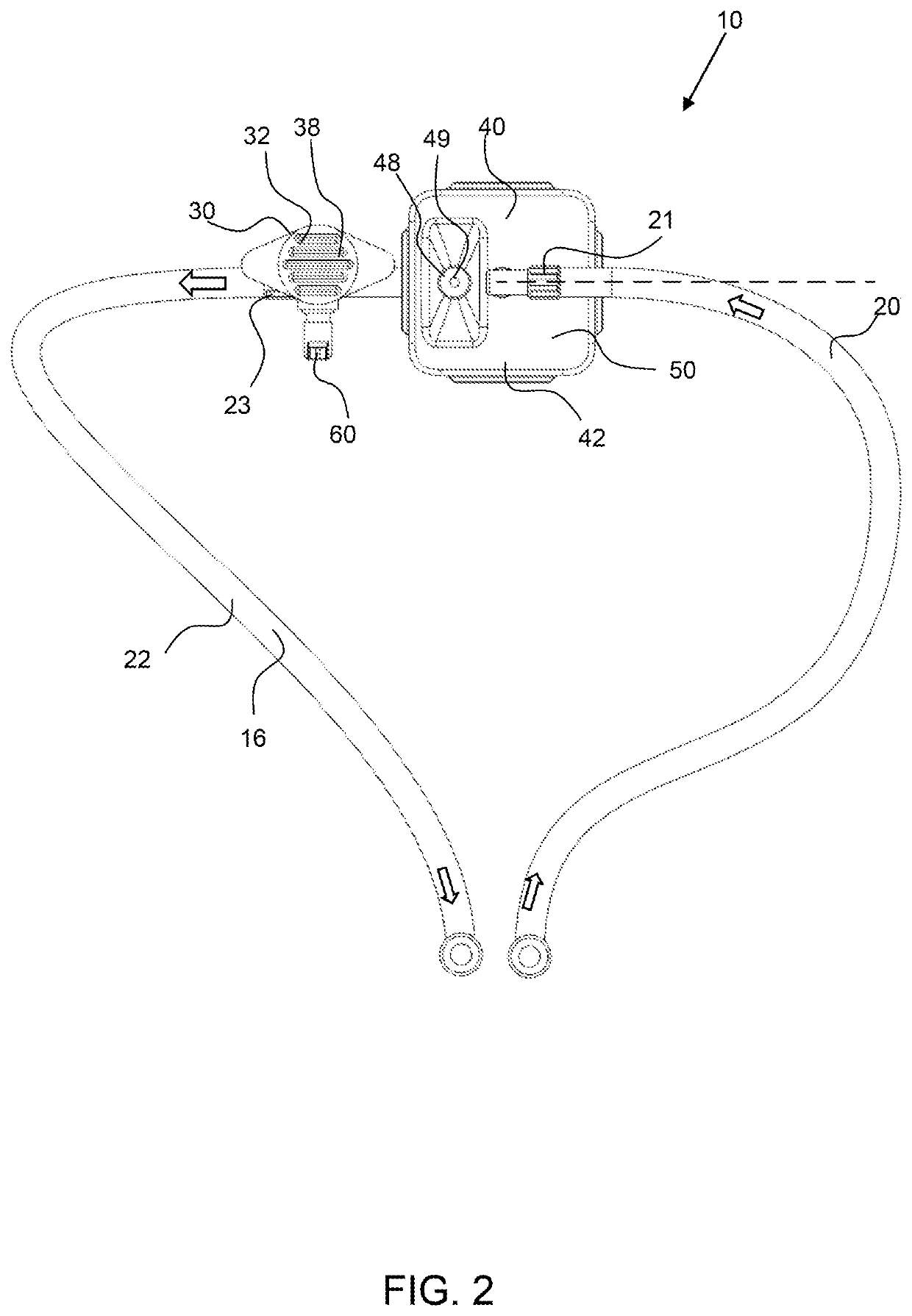 Manual clot aspiration and filtration system and method of removing a clot