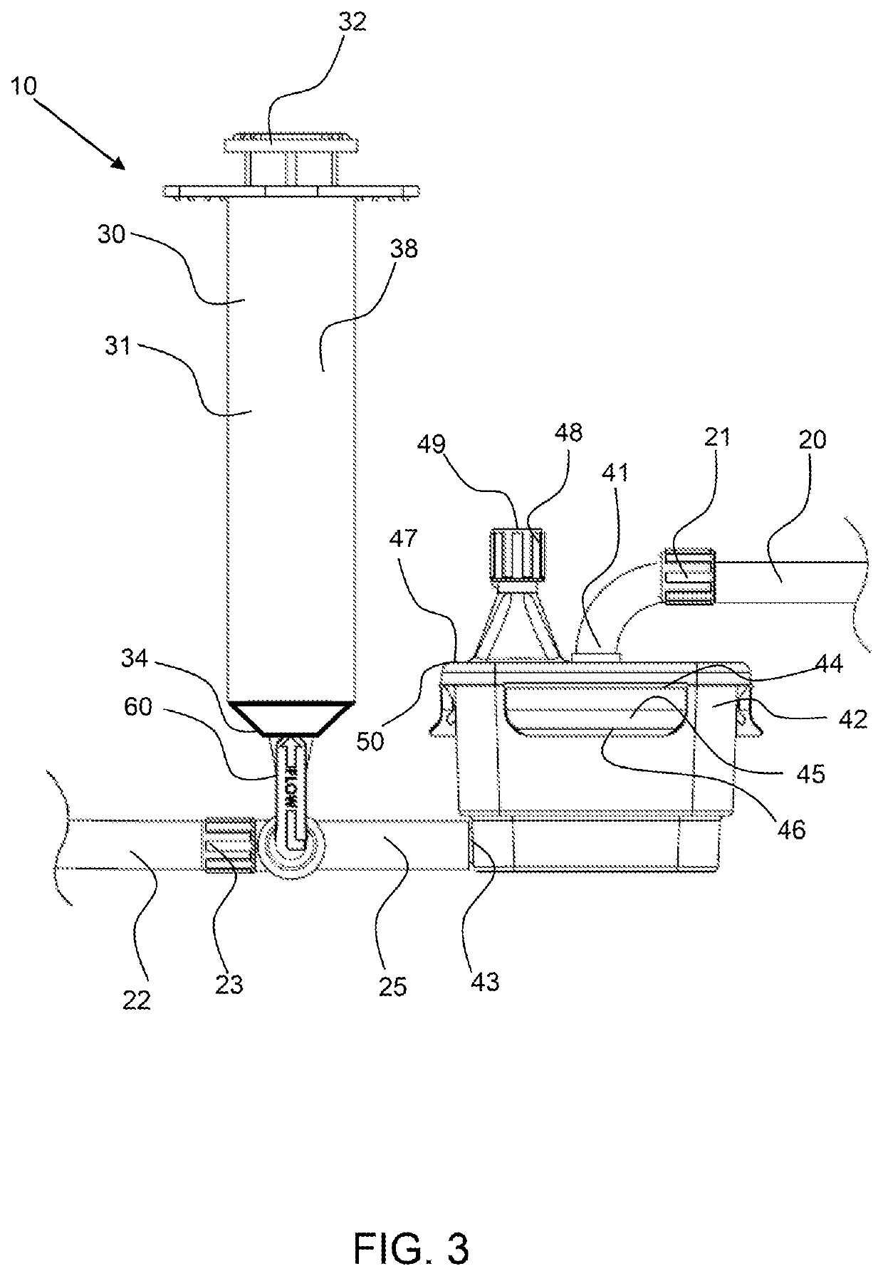 Manual clot aspiration and filtration system and method of removing a clot