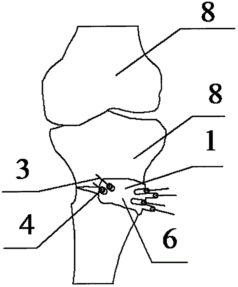 Navigation device capable of accurately positioning high tibial osteotomy, and manufacturing method of navigation device