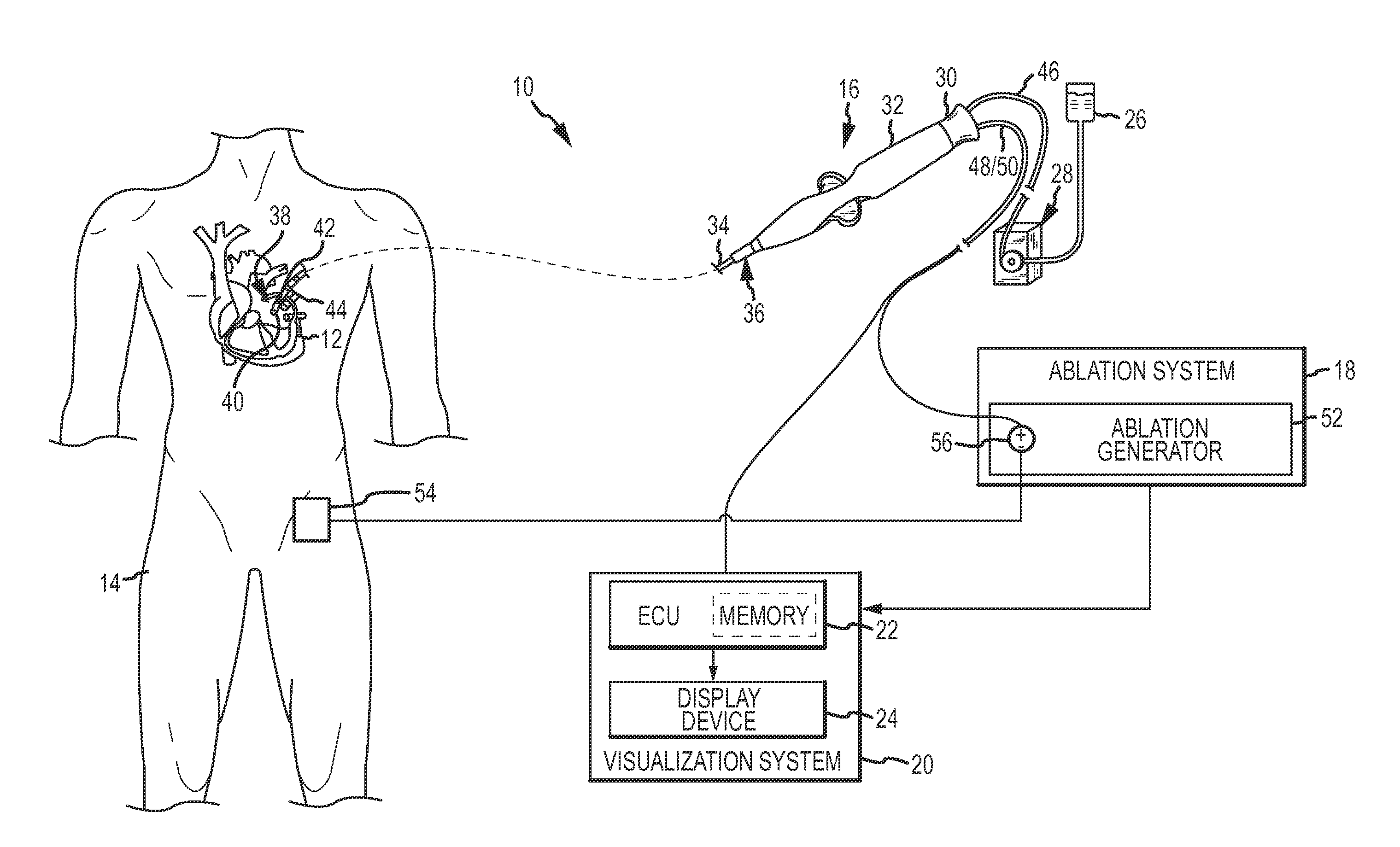 Catheter electrode assemblies and methods of construction therefor