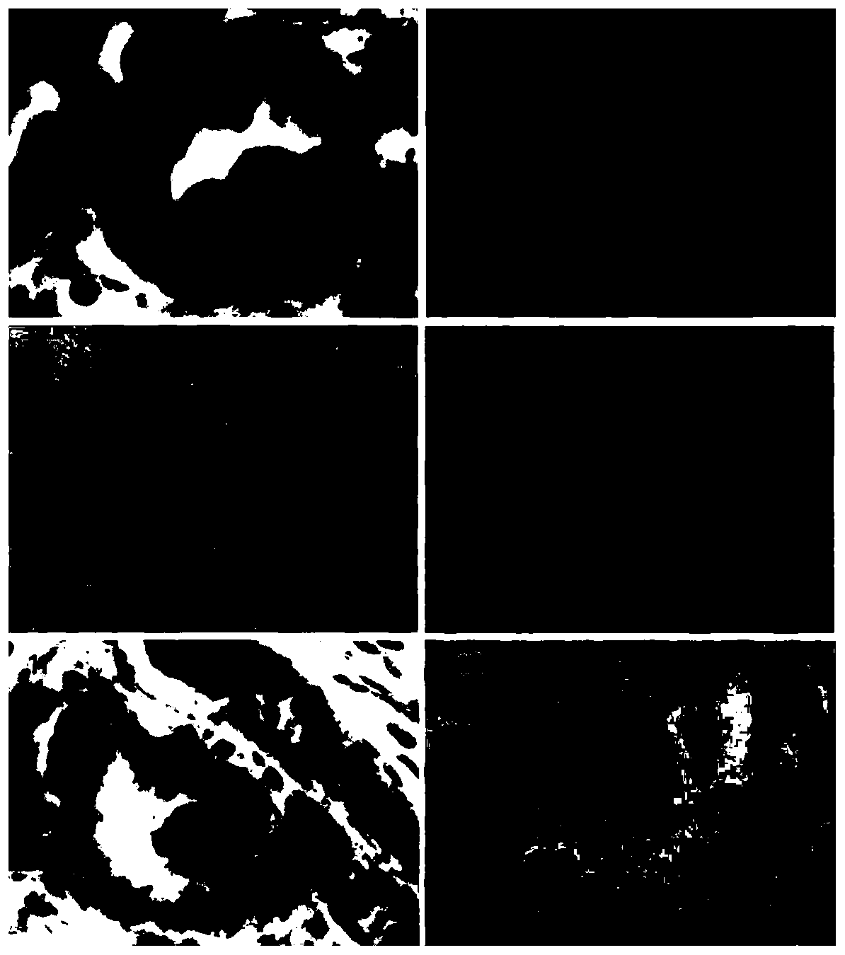 Immunohistochemical double-molecular-target single staining kit as well as using method and application thereof