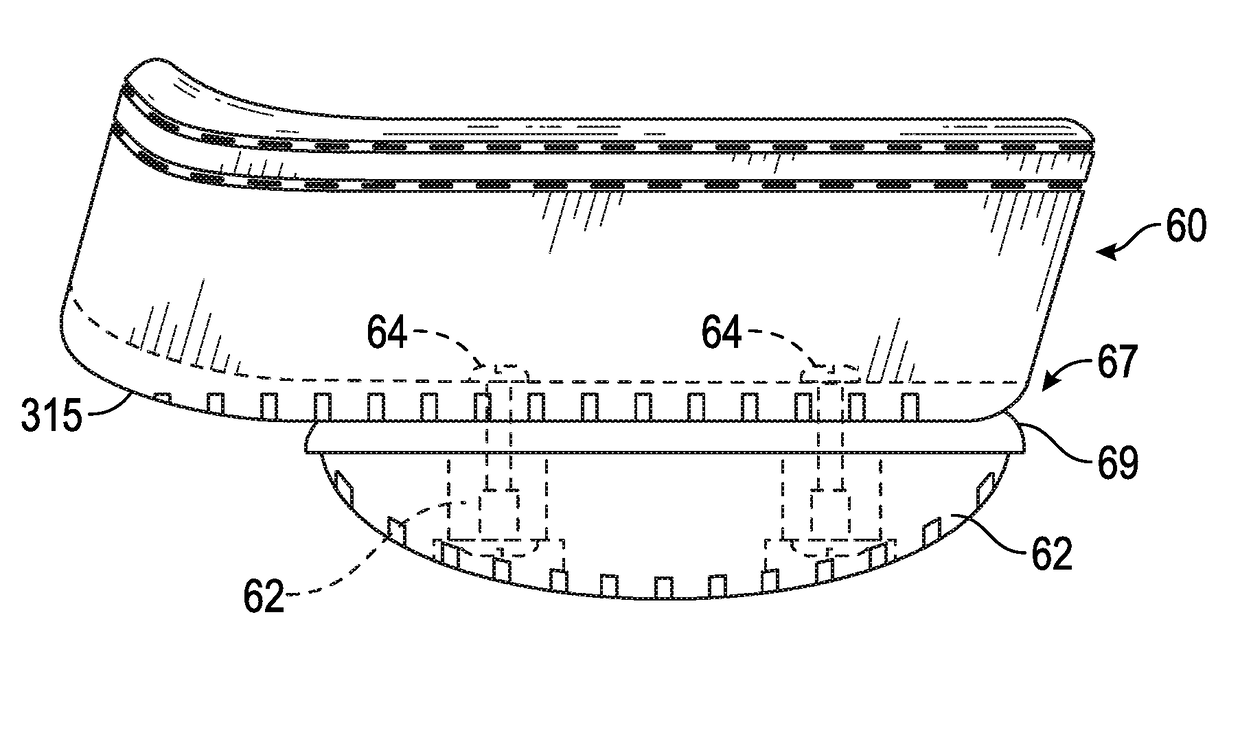 Rocker shoe and attachment for an equine boot assembly