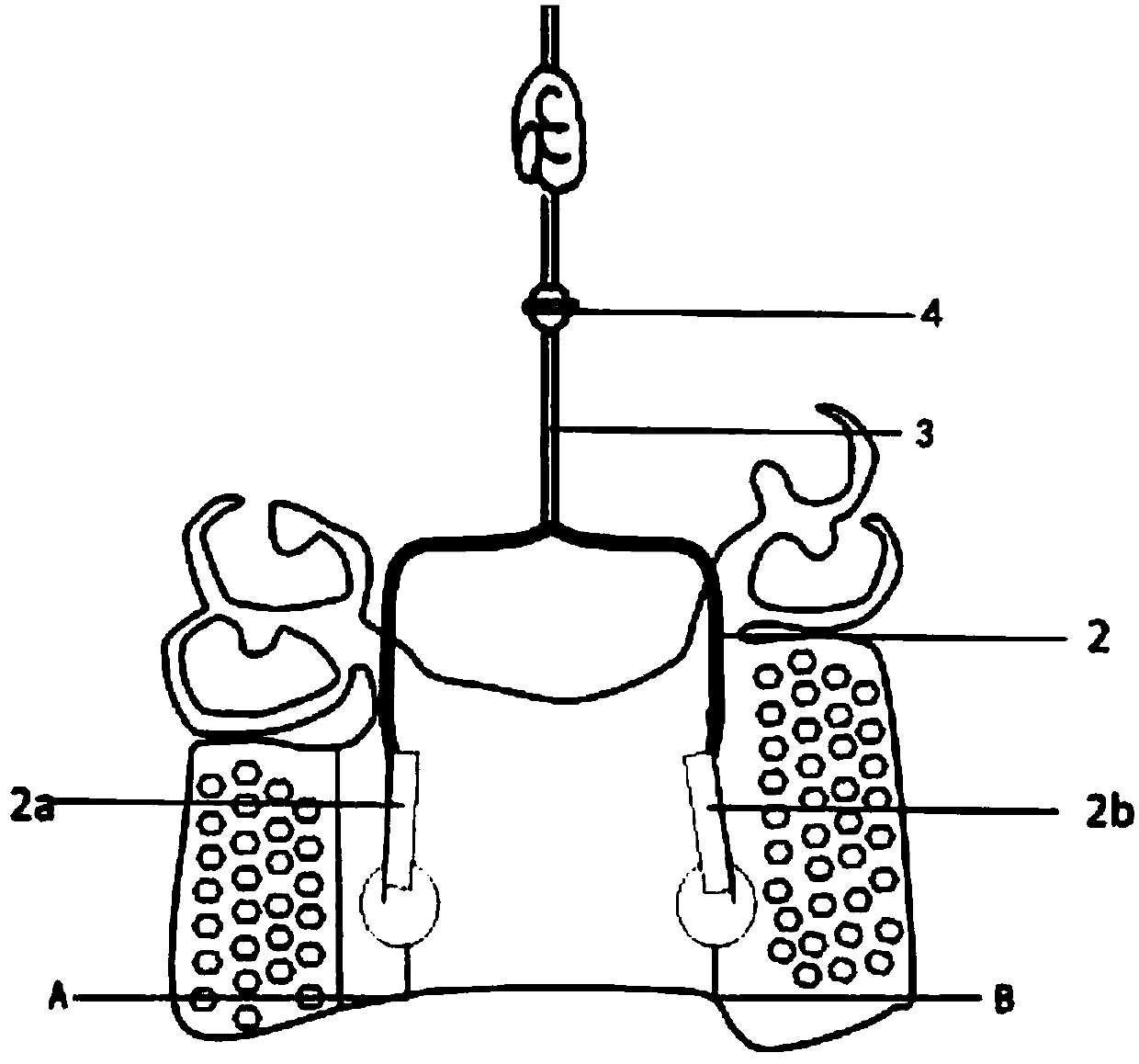 Removable partial denture wearing and removing device, matching denture base and use method thereof