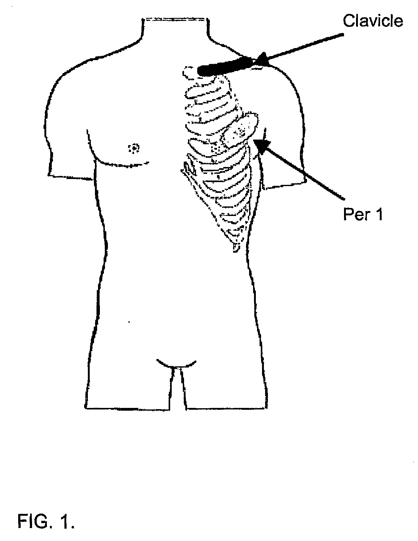 Method of determining the sympathetic tone and system for measurement thereof