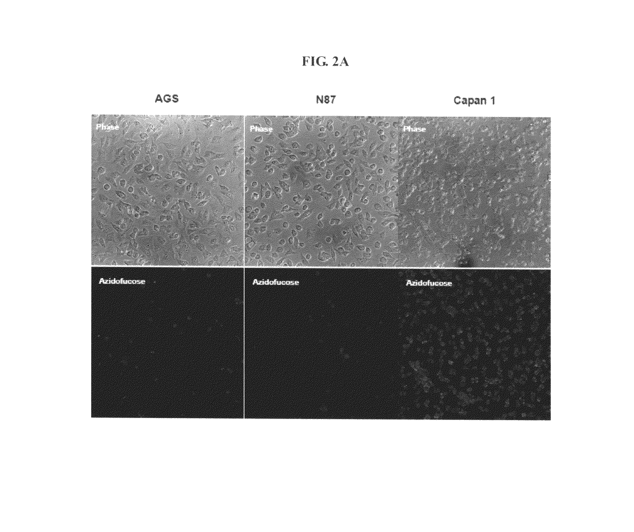 Compositions and assays for treatment and diagnosis of helicobacter pylori infection and conditions