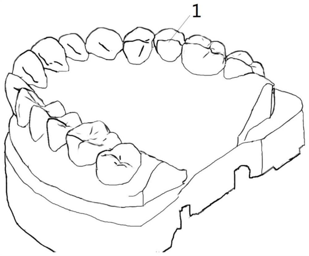 Digital metal gingival wall lifting guide plate and manufacturing method thereof