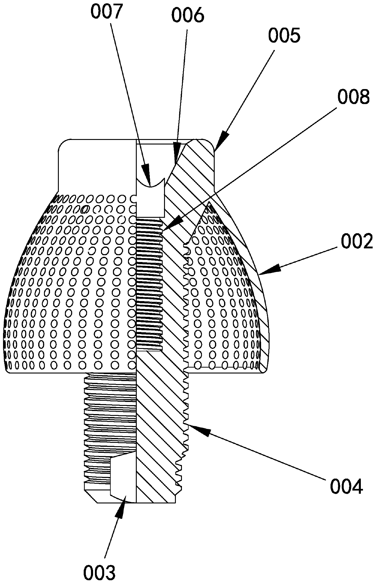 Personalized dental implant with alveolar bone repair network and preparation method of implant