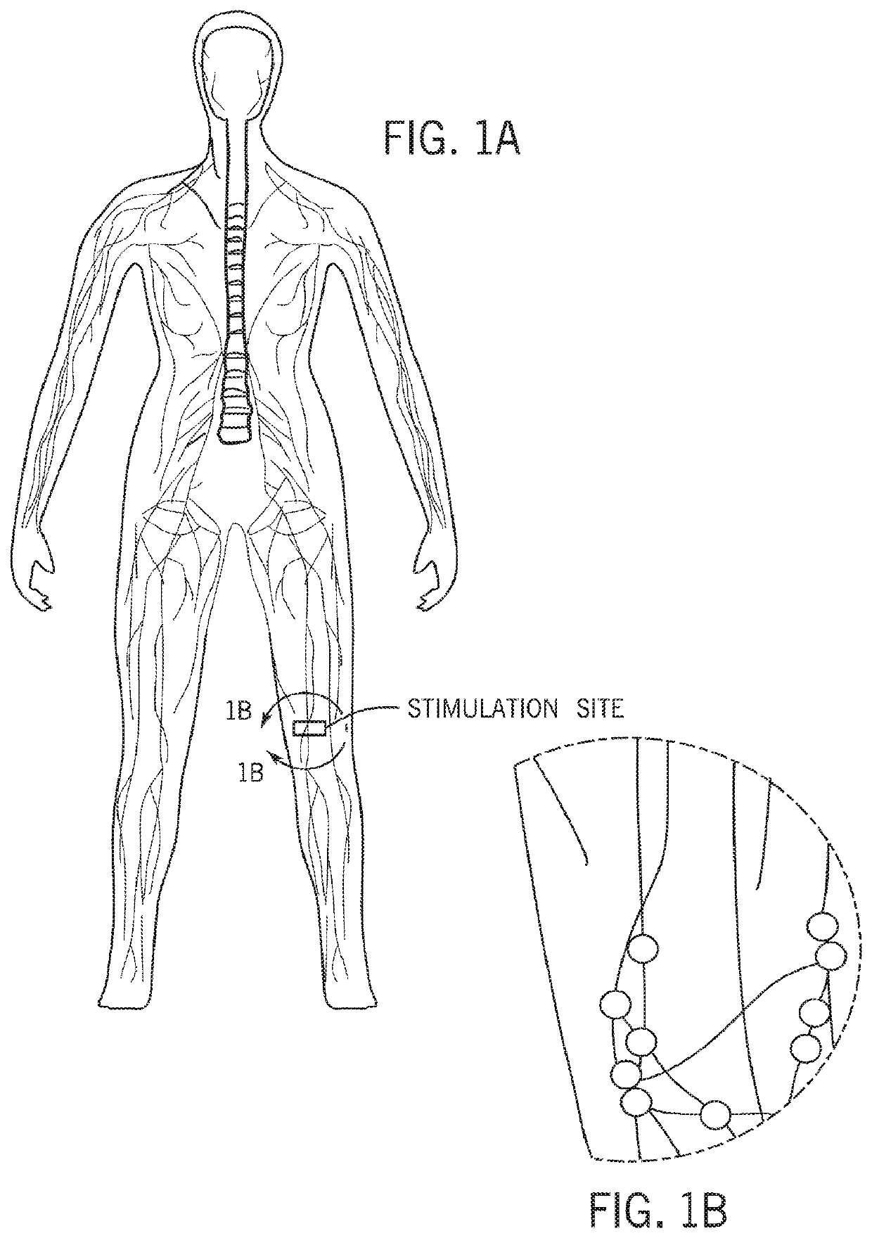 Techniques for neuromodulation