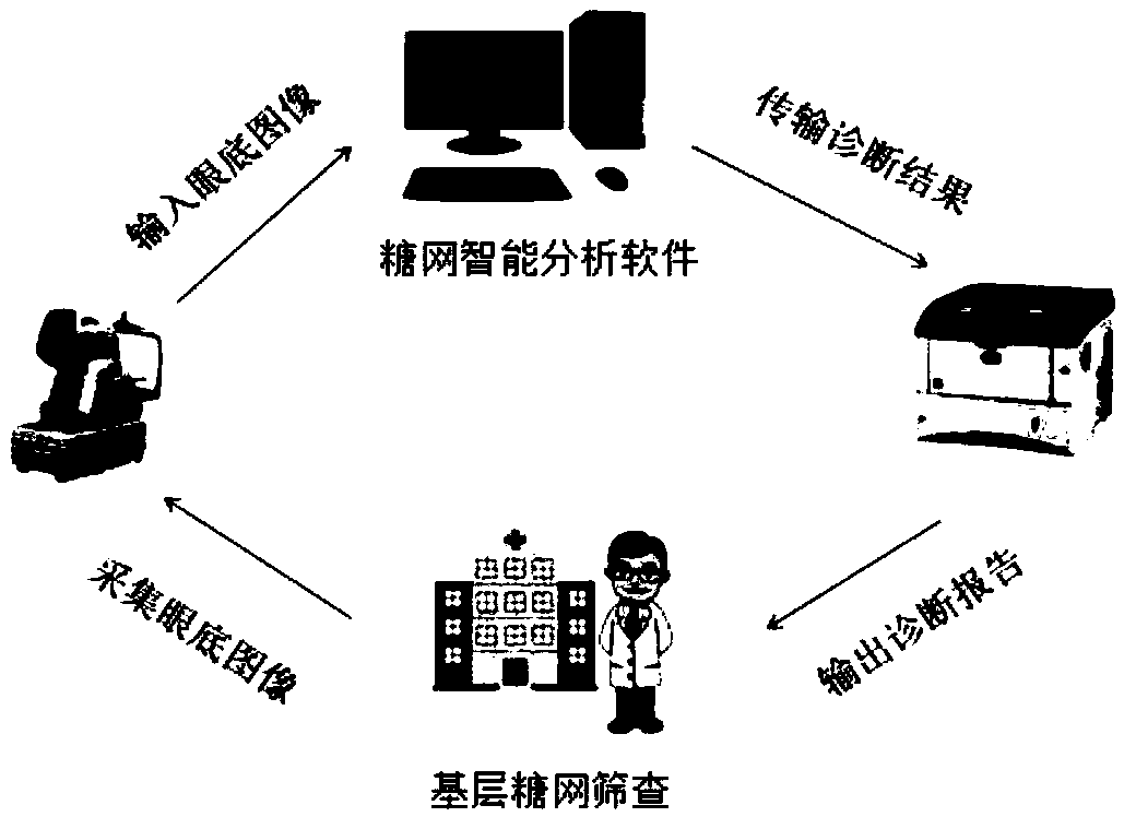 System for screening diabetic retinopathy